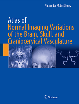 Atlas of Normal Imaging Variations of the Brain, Skull, and Craniocervical Vasculature Cover Image
