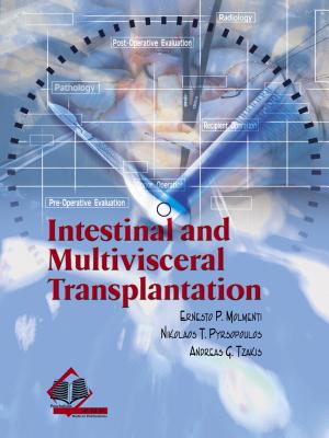 Intestinal and Multivisceral Transplantation By Ernesto P. Molmenti Cover Image