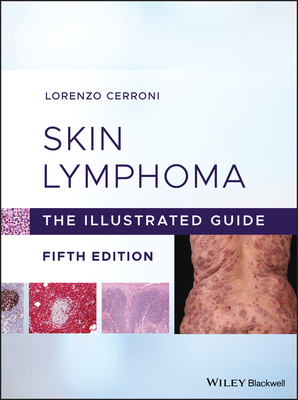 Skin Lymphoma Cover Image