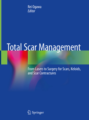 Total Scar Management: From Lasers to Surgery for Scars, Keloids, and Scar Contractures By Rei Ogawa (Editor) Cover Image