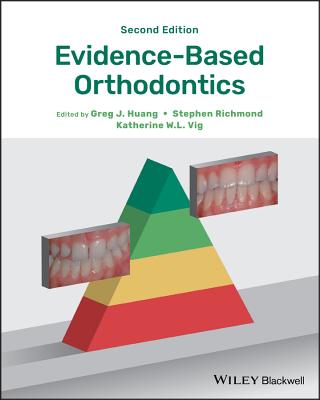 Evidence-Based Orthodontics Cover Image