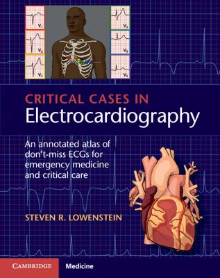 Critical Cases in Electrocardiography: An Annotated Atlas of Don't-Miss Ecgs for Emergency Medicine and Critical Care Cover Image