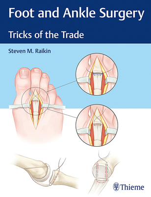 Foot and Ankle Surgery: Tricks of the Trade By Steven M. Raikin Cover Image