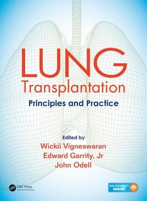 Lung Transplantation: Principles and Practice Cover Image