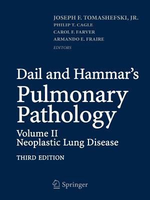 Dail and Hammar's Pulmonary Pathology: Volume II: Neoplastic Lung Disease
