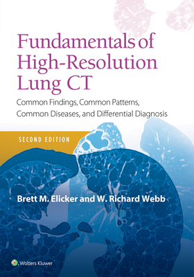 Fundamentals of High-Resolution Lung CT: Common Findings, Common Patterns, Common Diseases and Differential Diagnosis By Brett M. Elicker, MD, W. Richard Webb Cover Image
