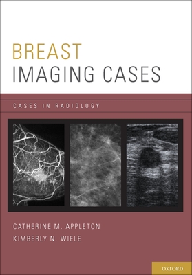 Breast Imaging Cases (Cases in Radiology) Cover Image