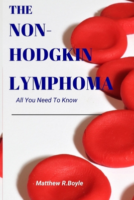 The Non-Hodgkin Lymphoma: All You Need To Know Cover Image