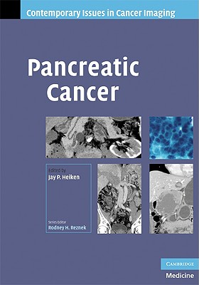 Pancreatic Cancer (Contemporary Issues in Cancer Imaging) By Jay Heiken (Editor) Cover Image