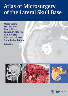 Atlas of Microsurgery of the Lateral Skull Base (Hardcover