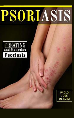 Psoriasis: Treating and Managing Psoriasis Cover Image