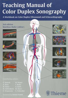 Teaching Manual of Color Duplex Sonography By Matthias Hofer, Medidak Publishing Gmbh, Andreas Dietz (Contribution by) Cover Image