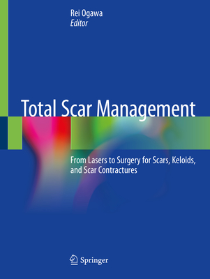 Total Scar Management: From Lasers to Surgery for Scars, Keloids, and Scar Contractures By Rei Ogawa (Editor) Cover Image