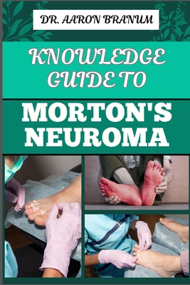 Knowledge Guide to Morton's Neuroma: Essential Manual To Symptoms, Diagnosis, Treatment, And Pain Relief For Foot Health And Nerve Pain Management Cover Image
