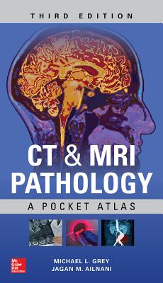 CT & MRI Pathology: A Pocket Atlas, Third Edition Cover Image