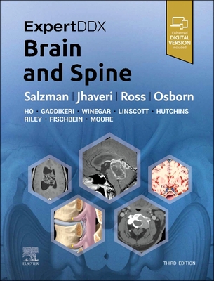 ExpertDDx: Brain and Spine: 9780323443081: Medicine & Health
