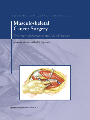 Musculoskeletal Cancer Surgery: Treatment of Sarcomas and Allied Diseases Cover Image