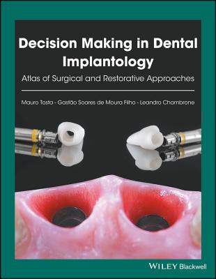 Decision Making in Dental Implantology: Atlas of Surgical and Restorative Approaches Cover Image