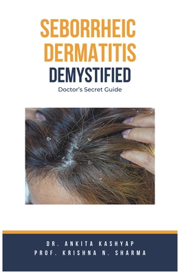 Seborrheic Dermatitis Demystified: Doctor's Secret Guide Cover Image