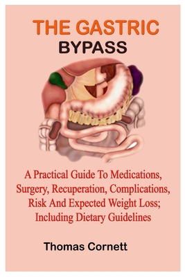 The Gastric Bypass: A Practical Guide to Medications, Surgery, Recuperation, Complications, Risk and Expected Weight Loss; Including Dieta Cover Image