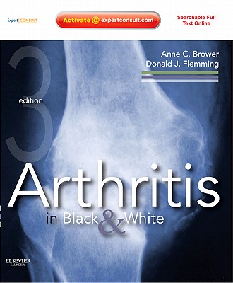 Arthritis in Black & White