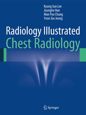Radiology Illustrated: Chest Radiology Cover Image