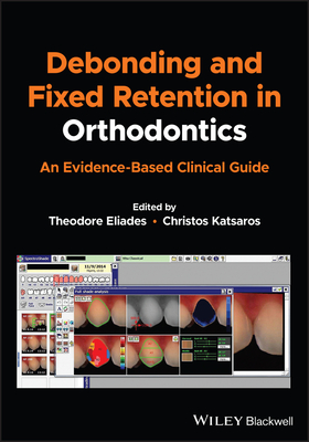 Debonding and Fixed Retention in Orthodontics: An Evidence-Based Clinical Guide Cover Image