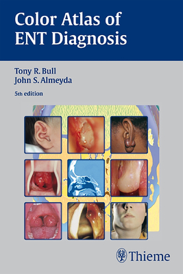 Color Atlas of ENT Diagnosis Cover Image
