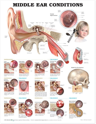 Middle Ear Conditions Anatomical Chart  Cover Image