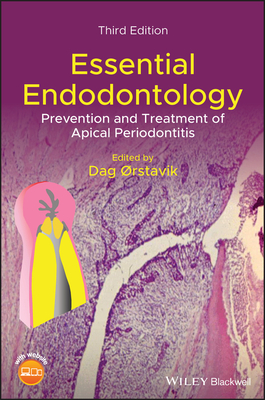 Essential Endodontology: Prevention and Treatment of Apical Periodontitis Cover Image