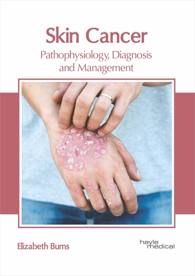 Skin Cancer: Pathophysiology, Diagnosis and Management Cover Image