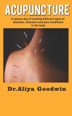 Acupuncture: A Natural Way of Treating Different Types of Diseases, Disorders and Pain Conditions in the Body Cover Image