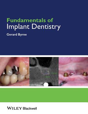 Fundamentals of Implant Dentistry Cover Image
