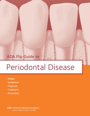 ADA Flip Guide to Periodontal Disease Cover Image