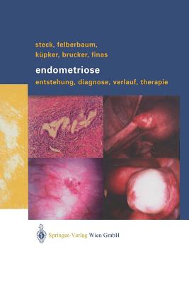 Endometriose: Entstehung, Diagnose, Verlauf Und Therapie Cover Image