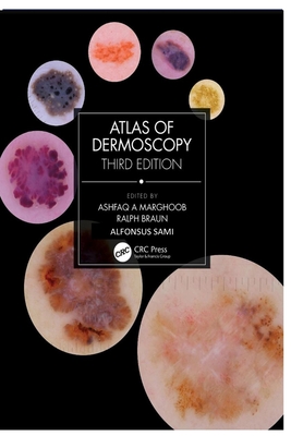 Atlas of Dermoscopy: Third Edition Cover Image