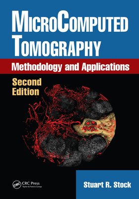 Microcomputed Tomography: Methodology and Applications, Second Edition By Stuart R. Stock Cover Image