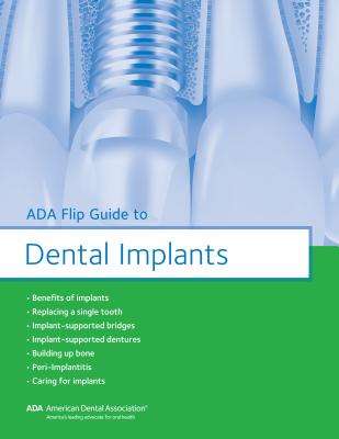 ADA Flip Guide to Dental Implants Cover Image