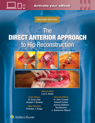 The Direct Anterior Approach to Hip Reconstruction By Lee E. Rubin, B. Sonny Bal, Joseph T. Moskal Cover Image