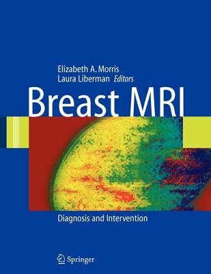Breast MRI: Diagnosis and Intervention Cover Image