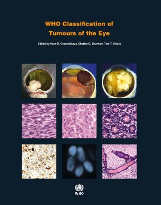 Who Classification of Tumours of the Eye Cover Image