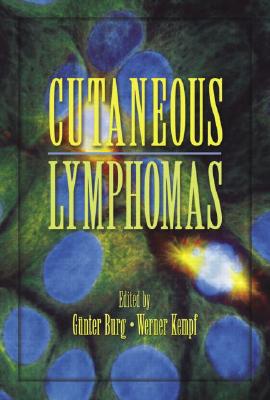 Cutaneous Lymphomas (Basic and Clinical Dermatology #32)