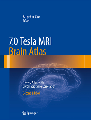 7.0 Tesla MRI Brain Atlas: In-Vivo Atlas with Cryomacrotome Correlation Cover Image
