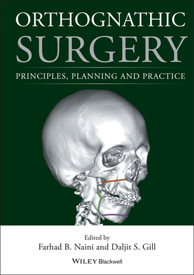 Orthognathic Surgery: Principles, Planning and Practice Cover Image