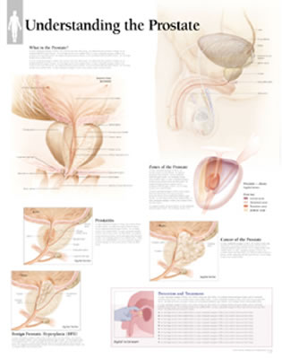 Understanding the Prostate: Wall Chart Cover Image