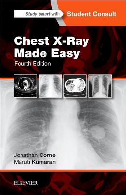 Chest X-Ray Made Easy By Jonathan Corne, Maruti Kumaran Cover Image