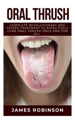 Oral Thrush: Complete Revolutionary and Tested Treatment to Effectively Cure Oral Thrush Once and For All By James Robinson Cover Image