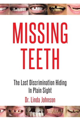 Missing Teeth: The Last Discrimination Hiding in Plain Sight By Linda Johnson Cover Image