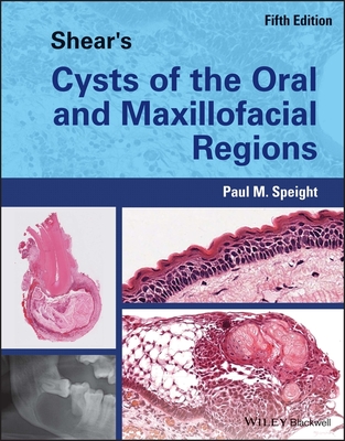 Shear's Cysts of the Oral and Maxillofacial Regions By Paul M. Speight Cover Image
