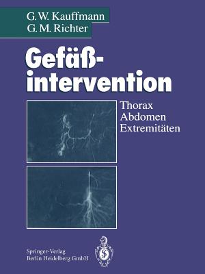 Gefäßintervention: Thorax, Abdomen, Extremitäten Cover Image